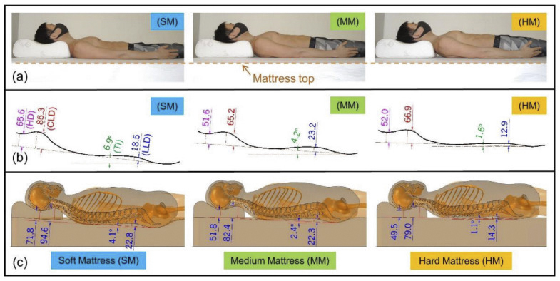 研究中實驗模性在三種床墊平躺時，假設枕頭不變，身體脊椎各角度的改變