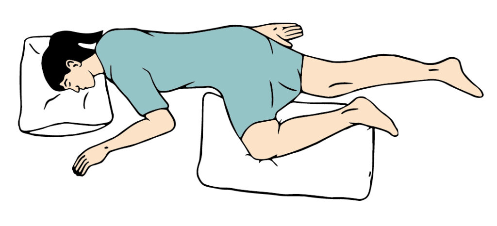 Sims體位也稱半俯臥位是指病人在側臥位和臥位之間呈半臥位，減少了骶骨和大轉子的壓力。