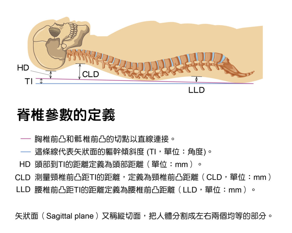 人體平躺時的脊椎參數定義。除了TI值是角度，其他都是以距離來說明。