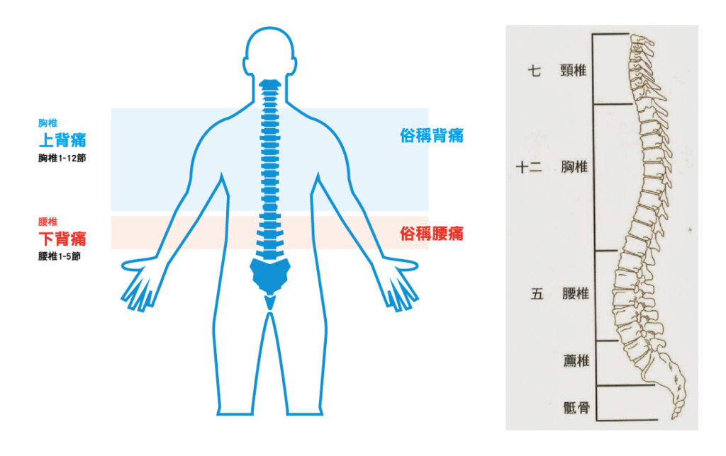 一般大家所說的「背痛」，在骨科中稱為上背痛，範圍是以胸椎第一節至第十二節位置；而「腰痛」就稱為下背痛（英語：Low Back Pain），範圍是腰椎第一節至腰椎第五節。