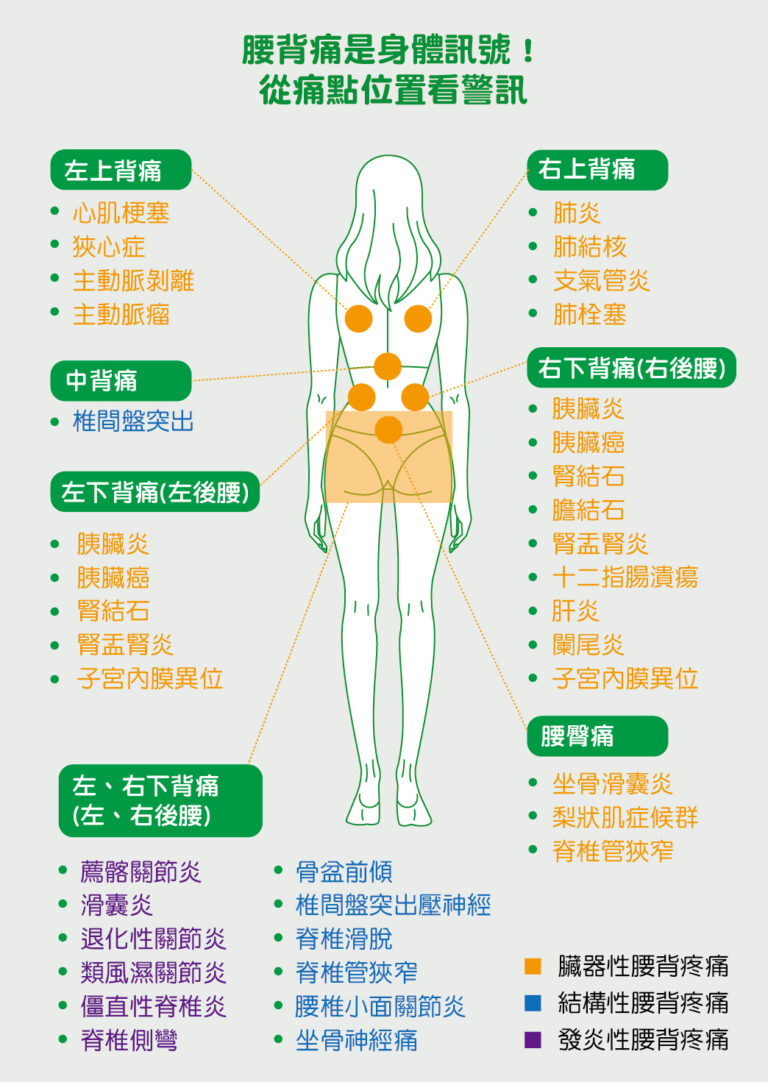 腰痛怎麼辦？腰痛位置有警訊！看懂左、右後腰痛的成因，5個方法舒緩腰痛 - 班尼斯睡眠健康家