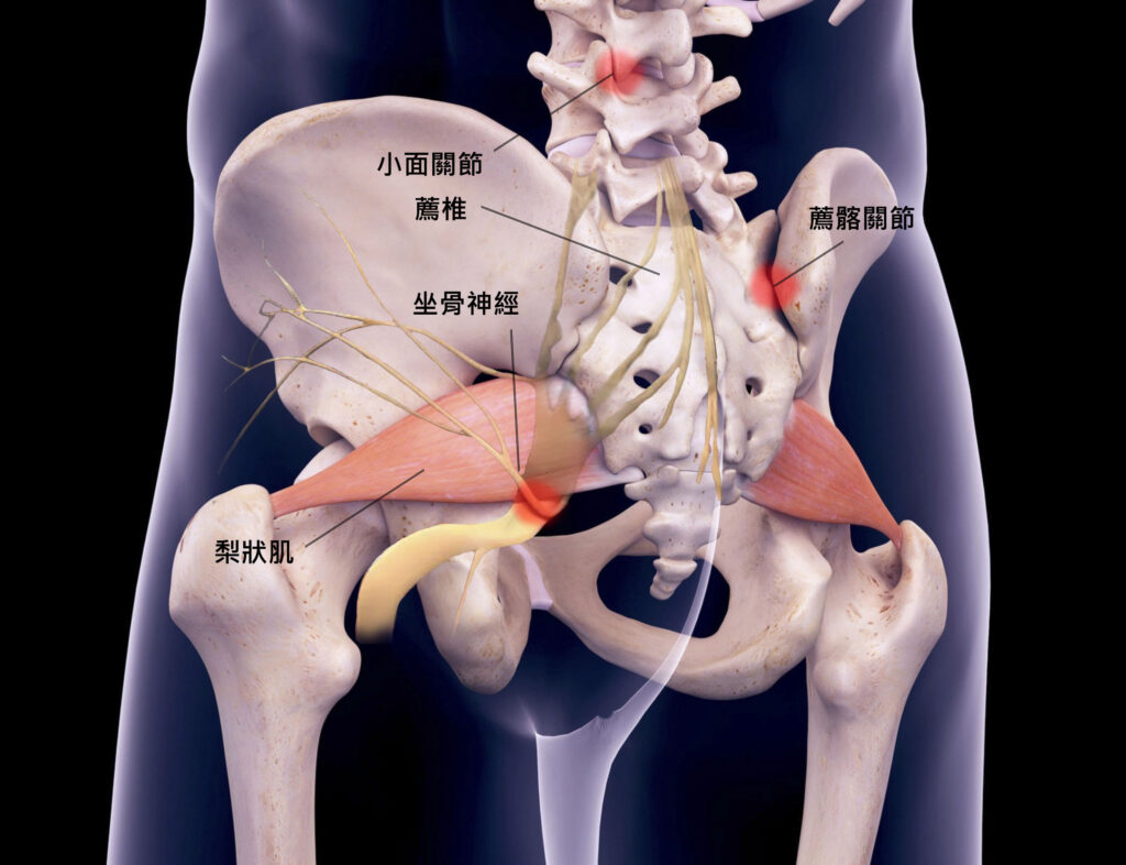 人體腰椎與薦椎周遭背面圖。對照上圖，是正面解剖，這張圖則是背面，也就是臀部附近的解剖圖。