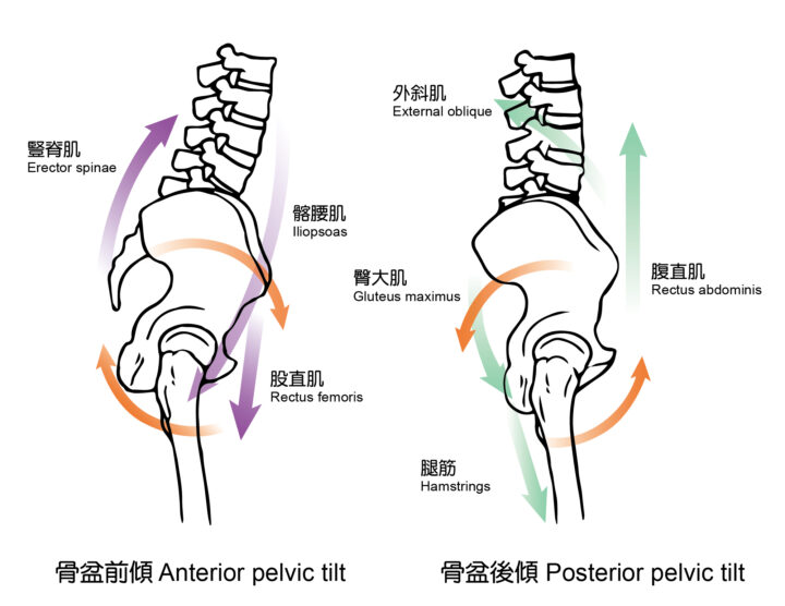 認識骨盆前傾與骨盆後傾、歪斜與旋轉，骨盆前傾睡覺矯正方法從睡姿與寢具下手 - 班尼斯睡眠健康家