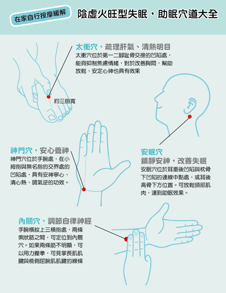 陰虛火旺型失眠，主要取太衝穴、神門穴、安眠穴、內關穴等穴道，特別是透過太衝穴梳理肝氣，內關穴調整自律神經，再搭配其他助眠穴道。太衝穴、神門穴、安眠穴、內關穴都有安定心神的助眠效果。