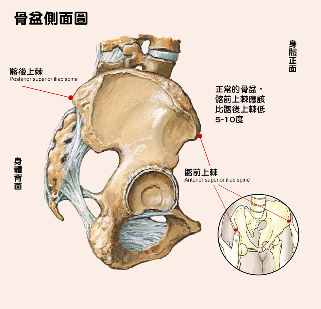 骨盆與骨盆前傾、骨盆後傾圖。圖中清楚標示髂前上棘與髂後上棘，右下圓圖中雙手拇指按壓的突出位置就是髂前上棘，讀者不妨自己摸摸看。