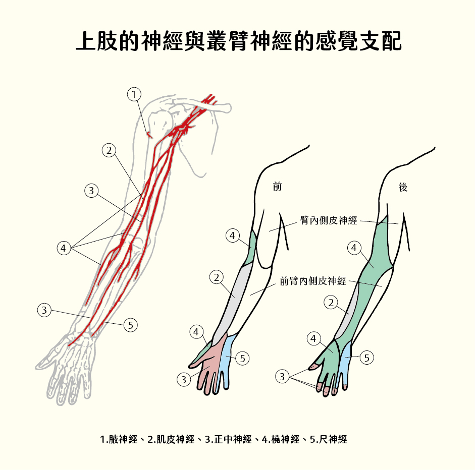 手麻原因就是上肢的神經與叢臂神經受到壓配，導致感覺支配傳達麻木疼痛感到脊隨，傳達到大腦。臂神經叢分岔延伸的神經當中，其中較為常見易受機械性刺激或壓迫而出現症狀的神經包括：橈神經、正中神經和尺神經。