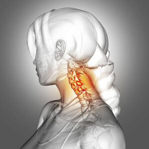 中老年人的肩頸痠痛通常與頸椎問題有關