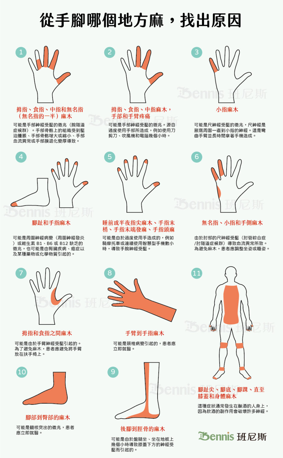 突然手麻原因？手指末梢麻、手指頭麻！如何分辨手麻？認識8類有手麻症狀的疾病 - 班尼斯睡眠健康家