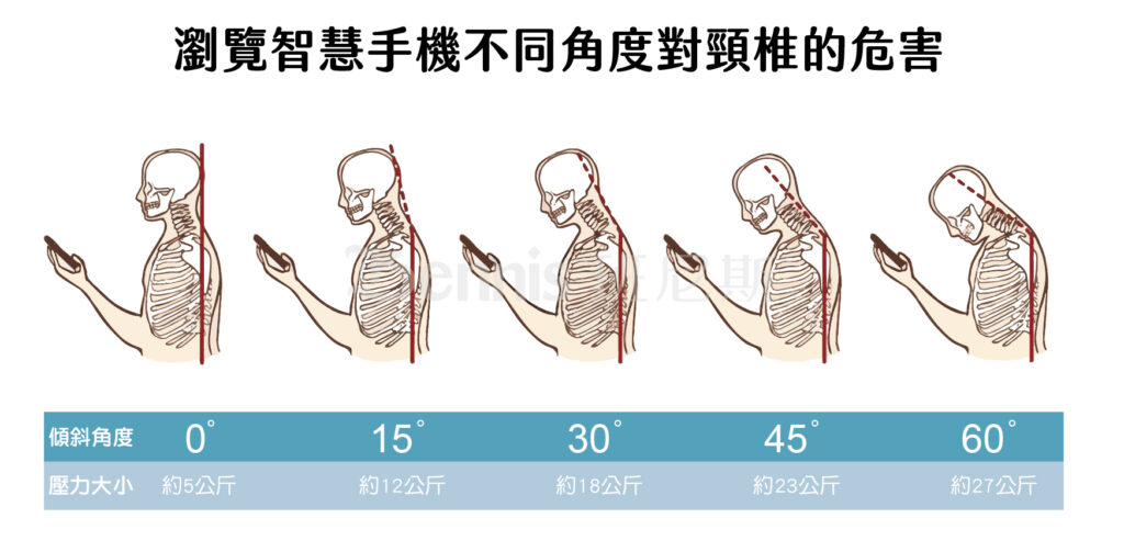 瀏覽智慧手機不同角度對頸椎的危害，這是造成現代人肩頸痠痛的主因之一