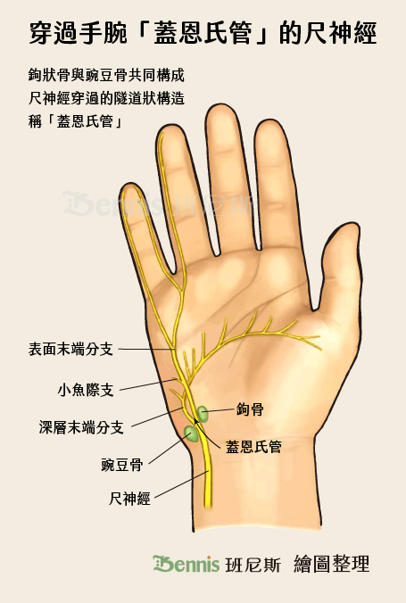 鉤狀骨與豌豆骨共同構成尺神經穿過的隧道狀構造，稱「蓋恩氏管」，尺神經受到壓迫又稱為騎士麻痺。與腕隧道症候群差別在於騎士麻痺是尺神經受到壓迫，尺神經靠近手掌小指側，而腕隧道症候群是正中神經受到壓迫，靠近大拇指側。兩者都是常見的手麻原因之一。