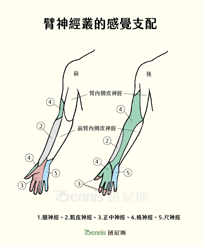 從臂神經叢了解手麻：臂神經叢的感覺支配。從這張圖可以找到手麻的位置是延伸到哪個部位，是哪條神經負責。