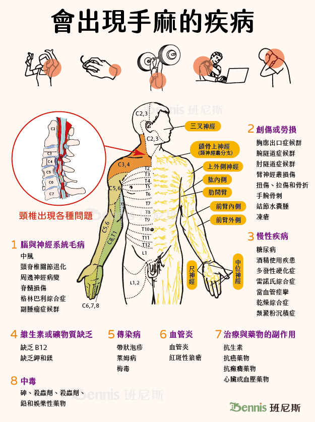 會出現手麻的疾病有很多，大約可以歸類為8種，其中更年期在醫學上不認為是疾病，其他以腦與神經、創傷勞損的問題為主要，其他還有慢性疾病、維生素b12缺乏、血管炎、傳染病、藥物副作用、中毒都會有手麻的症狀