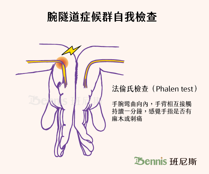 腕隧道症候群自我檢查方式是運用法倫氏檢查（Phalen test）方法