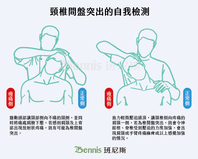 頸椎間盤突出的自我檢測