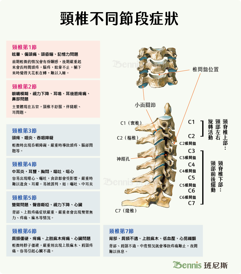 頸椎病發生在不同頸椎節段，會出現不同的症狀。這是因為每個節段穿出的脊椎神經不同。