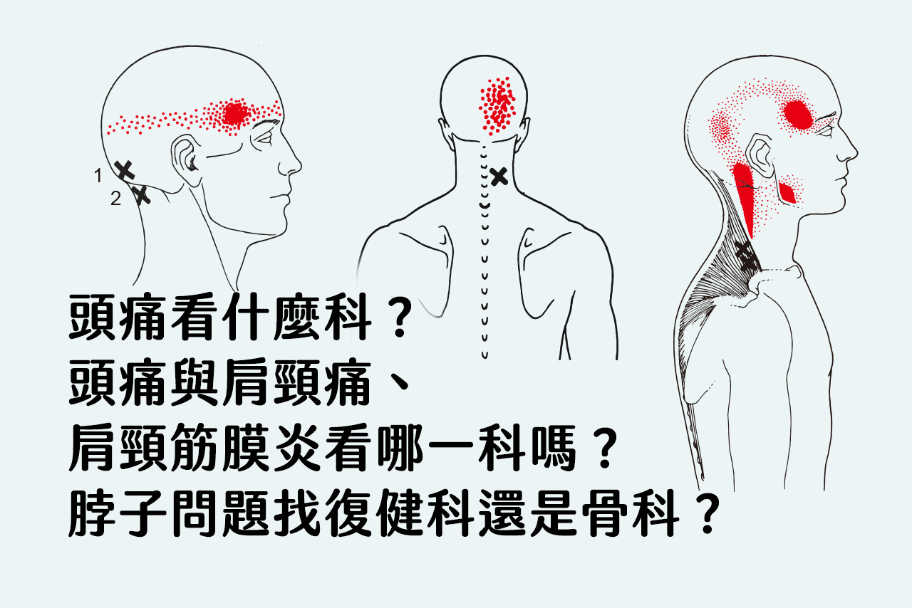 頭痛看什麼科？你知道頭痛與肩頸痛、肩頸筋膜炎看哪一科嗎？脖子問題找復健科還是骨科？