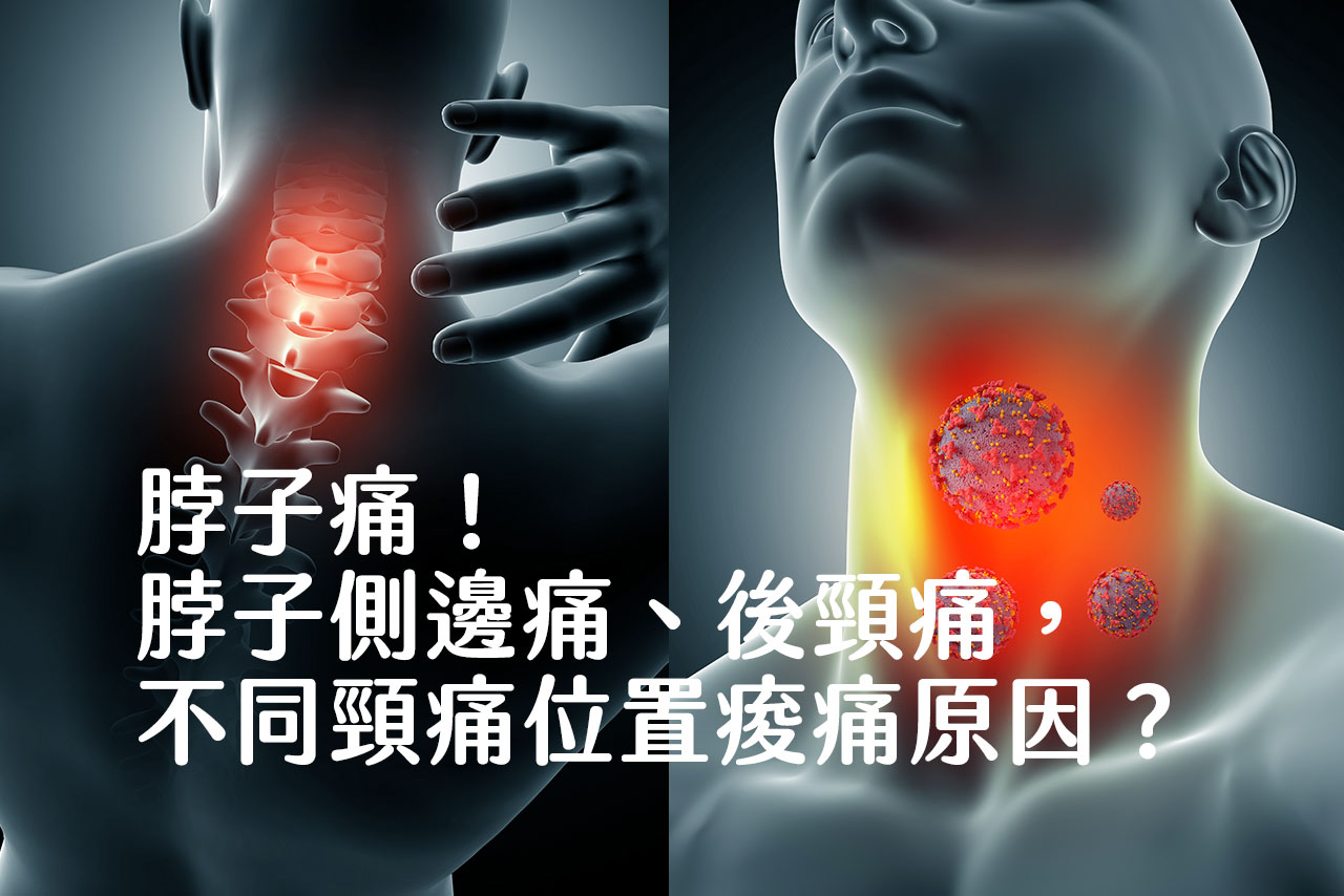 脖子痛!比較脖子側邊痛、後頸痛,不同頸痛位置痠痛原因? - 班尼斯睡眠健康家