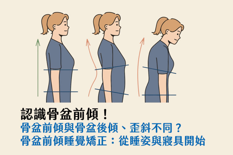 認識骨盆前傾與骨盆後傾、歪斜與旋轉，骨盆前傾睡覺矯正方法從睡姿與寢具下手 - 班尼斯睡眠健康家