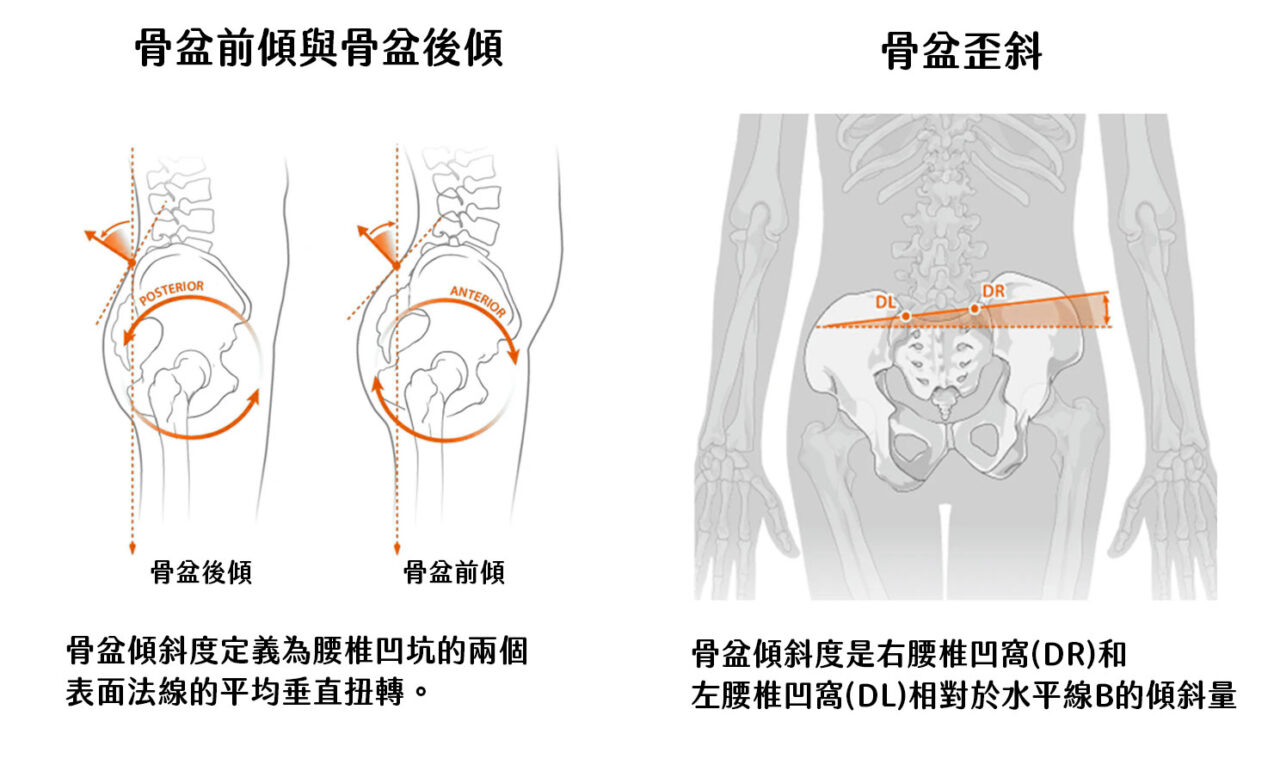 骨盆傾斜的圖示